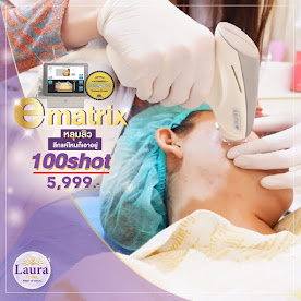 lauraclinic บริการรักษาหลุมสิวด้วยเลเซอร์ E-matrix เป็น ชื่อเครื่อง เลเซอร์รักษาหลุมสิว ที่เป็นที่นิยมที่สุดอันดับ 1 ของเมืองไทย