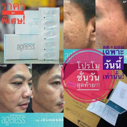 ด่วน ๆ !!! โบท็อกซ์แบบทามีแล้วนะ