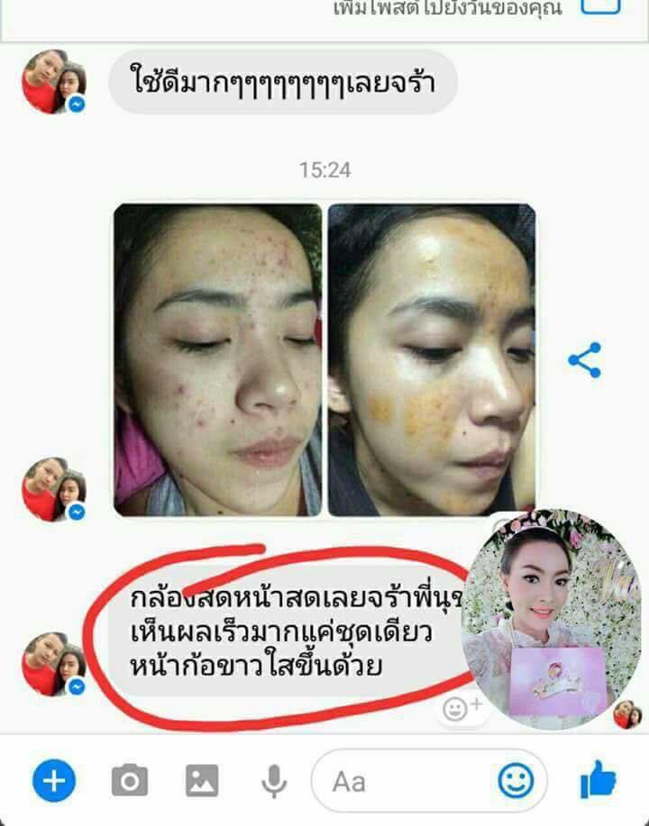 ครีมหน้าใสลูกปัด รักษาสิว ฝ้ากระ รอยสิว สิวอักเสบอุดตัน หน้าดำ หมองคล้ำหมดปัญสิวหายขาดโทร.091-9936546